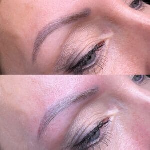 Vorher-Nachher Ergebnis nach Entfernung von altem Permanent Make-up an den Augenbrauen mit Remover in Hamburg