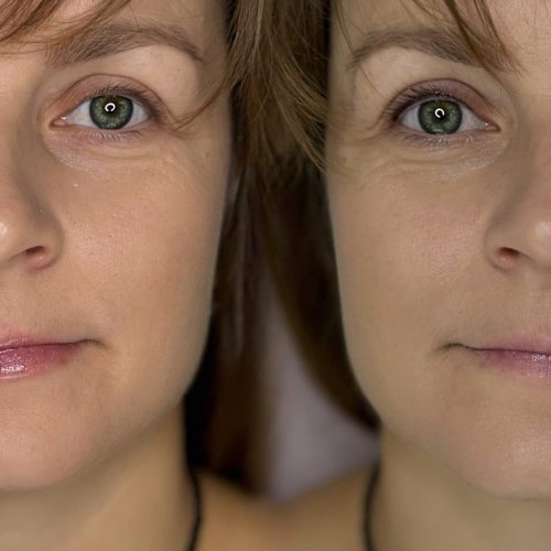 Wimpernkranzverdichtung Vorher-Nachher Permanent Make-up Hamburg Vorher-Nachher-Vergleich einer Wimpernkranzverdichtung mit Permanent Make-up bei Lena Kart in Hamburg